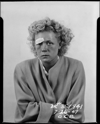 Babbit.
Front view of female from waist up seated wearing coat and arms are folded. Bandaged right brow.
26.07.1947.
Gelatin silver print.
Courtesy Fototeka Los Angeles